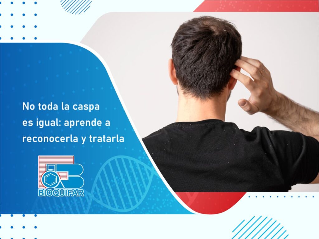 Tratamiento contra la caspa - Blog